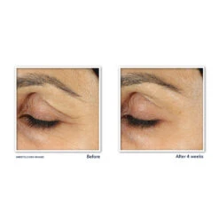 RoC Retinol Correxion Line Smoothing Oogcrème -Verzorgingsproducten 1021201 3