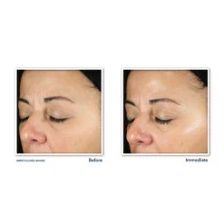 RoC Multi Correxion Daily Serum 6 RoC Multi Correxion Daily Serum -Verzorgingsproducten 1021205 3