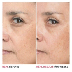 IT Cosmetics Bye Bye Lines Hyaluronic Acid Serum -Verzorgingsproducten 1072752 5