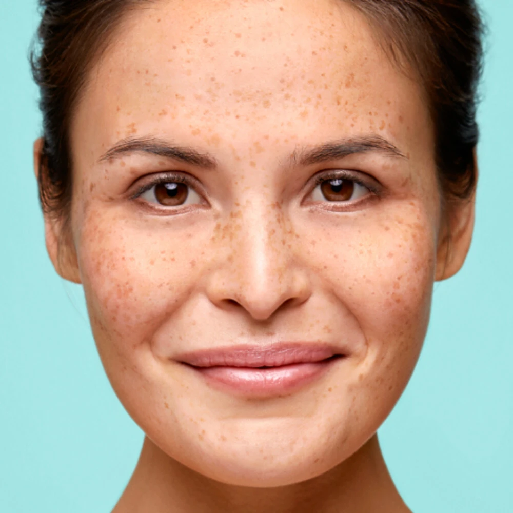 Biodermal Pure Balance Nachtbalsem Skin Refining 2 Biodermal Pure Balance Nachtbalsem Skin Refining - Afbeelding 2