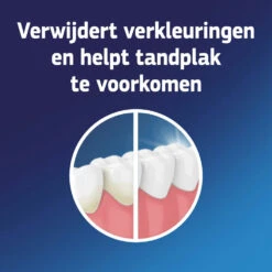 3x Fixodent Reinigingstabletten Complete Care -Verzorgingsproducten 998573 3 1